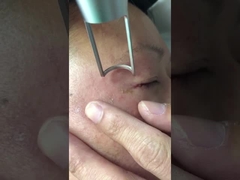 Máy Laser Picosecond 450ps 1064nm 532nm Q đã chuyển đổi Nd Yag