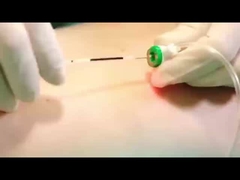 Máy lọc mỡ bằng laser